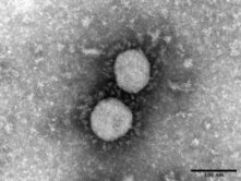新型コロナウイルスの変異株（デルタ型）の電子顕微鏡写真像（国立感染症研究所出典）