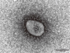 オミクロン株の電子顕微鏡写真（画像の提供は国立感染症研究所）